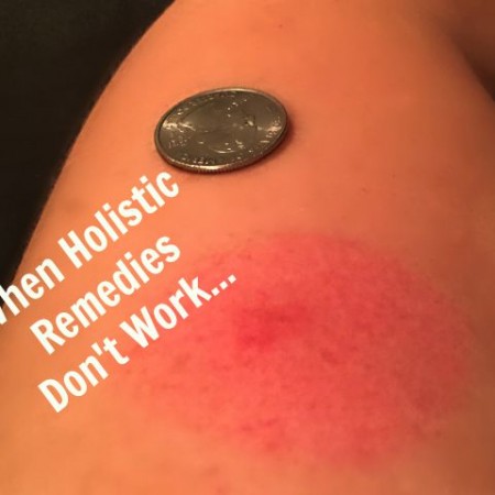 When Holistic Remedies Don't Work | In Johnna's Kitchen