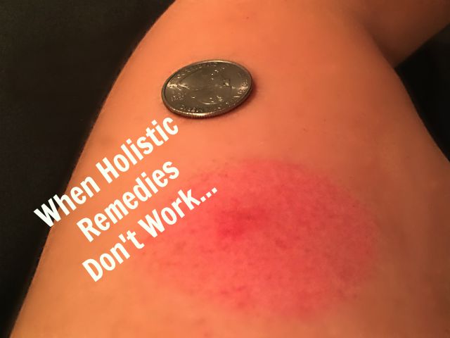 When Holistic Remedies Don't Work | In Johnna's Kitchen